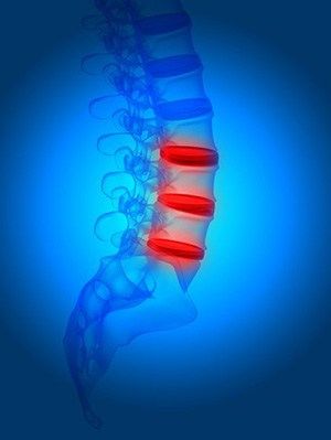 Lumbar Support a blue picture showing red discomfort in the spine