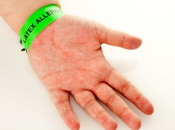 Latex Mattress Allergies What You Need To Know The Sleep Judge